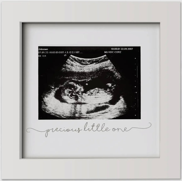 Baby Sonogram Picture Frame